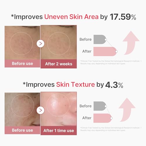 Medicube PDRN Pink Exosome Shot Serum, 2000 Needles, Korean Cosmetics (UNBOXJAPAN EXCLUSIVE)|B0DQCJ9T9N