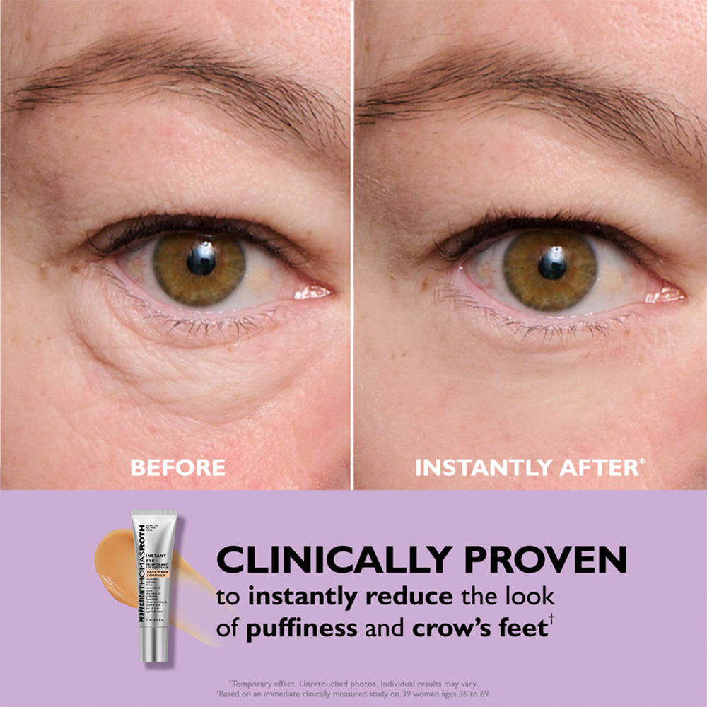 Rayenn Instant Eye & Forehead Tightener
