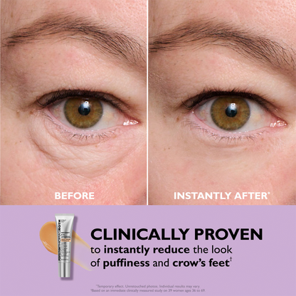 Rayenn Instant Eye & Forehead Tightener