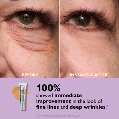 Rayenn Instant Eye & Forehead Tightener