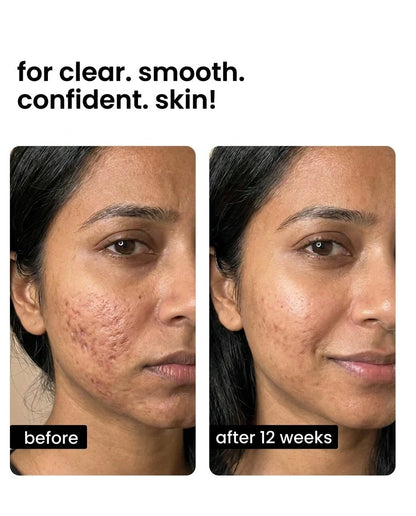 Rayenn Copper Peptide Scar Repair Serum