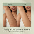 Rayenn Hair Removal Trilogy Kit — before after