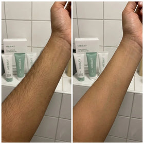 Rayenn Hair Removal Trilogy Kit — customer photo 6